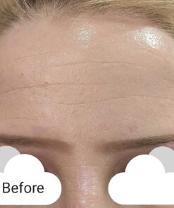 Frownies Forehead and Between Eyes Wrinkle Patches The Original Wrinkle Patch Non Invasive Wrinkle Smoothers for Forehead Wrinkles 44 81mWBGUMk6L