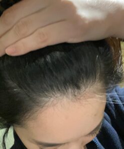 artnaturals Argan Hair Growth Shampoo - (16 Fl Oz / 473ml) - Sulfate Free - Treatment for Hair Loss, Thinning & Regrowth - Men & Women - Infused with Biotin, Argan Oil, Keratin, Caffeine 36 81mzGgdlD4L