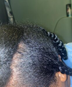 Nizoral Anti-Dandruff Shampoo with 1% Ketoconazole, Fresh Scent, 7 Fl Oz 58 81nRu6 AbqL