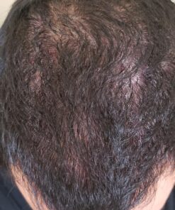 artnaturals Argan Hair Growth Shampoo - (16 Fl Oz / 473ml) - Sulfate Free - Treatment for Hair Loss, Thinning & Regrowth - Men & Women - Infused with Biotin, Argan Oil, Keratin, Caffeine 44 81nngubcSWL