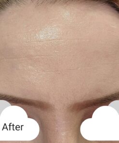 Frownies Forehead and Between Eyes Wrinkle Patches The Original Wrinkle Patch Non Invasive Wrinkle Smoothers for Forehead Wrinkles 45 81npGY7cO0L