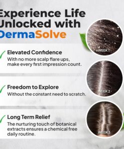 Dermasolve 4 oz Psoriasis, Seborrheic Dermatitis, & Dandruff Scalp Oil 2 Pack | Dermatologist Approved | Flaky Scalp Relief | Clinically Tested, Long-Lasting Itch-Free, High-Performance Formula 4 Ounce (Pack of 2) 17 81pG 2SB2VL