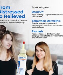 Dermasolve 4 oz Psoriasis, Seborrheic Dermatitis, & Dandruff Scalp Oil 2 Pack | Dermatologist Approved | Flaky Scalp Relief | Clinically Tested, Long-Lasting Itch-Free, High-Performance Formula 4 Ounce (Pack of 2) 20 81rmEKSLh2L