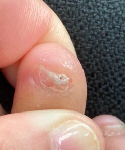 PURELY NORTHWEST-Tea Tree Oil & Peppermint Foot Soak with Epsom Salt-for Stubborn Foot Odor, Athletes Foot Burning & Itching, Damaged Discolored Nails-A Natural Callus Remover 16 Ounces 1 Pound (Pack of 1) 46 81sQAbDVe8L