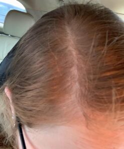 DrFormulas HairOmega DHT Blocker Biotin 5000 mcg Vitamins for Hair Growth Supplement | Hair Loss Pills for Women and Men, 30 Day Supply 60 Count (Pack of 1) 25 81sQvOYVvbL