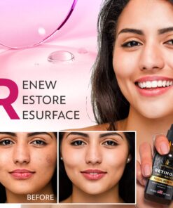 DOUBLE SIZED (2Oz) Retinol Serum for Face with Hyaluronic Acid + Vitamin E and A + Aloe Vera Anti-Aging Serum Pore Tightener Fade Dark Spots Clinical Strength Formula by InstaSkincare 2 Fl Oz (Pack of 1) 24 81vJDwzagVL