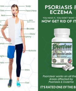 Psorclear-Psoriasis & Eczema Relief | A Proven Effective and All-Natural Product for Psoriasis Eczema & Rosacea Relief That Works - Rated One of The Best (120 Count Bottle) 16 81voUm tTL