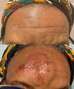 (4 Pack) Globe Bacitracin Zinc Ointment + Aloe 1oz, Antibiotic Ointment, Essential Antibiotic First Aid Supplies, Healing Action, Maximum Antibiotic Power, Prevents Infection in cuts, scrapes, Burns 28 81wX4w8uBfL