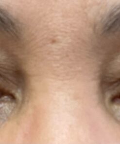 LUMIFY Redness Reliever Eye Drops 0.17 Fl Oz (5 mL) 31 81wp6 R9rKL