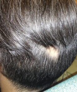 Growth Treatment Unscented 5% (Foam) 2 Ounce (Pack of 1) 14 81xKoUuPRnL