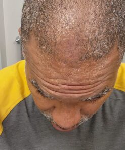 iRestore Essential Laser Hair Growth System - FDA Cleared Hair Loss Treatments for Men & Women & Hair Growth Products for Men with Thinning Hair, Hair Regrowth Treatments Laser Cap, Red Light Therapy 43 81ytFWA4A8L