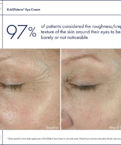 Obagi ELASTIderm Eye Cream 0.5 oz 0.5 Ounce (Pack of 1) 15 81zaLyg98mL