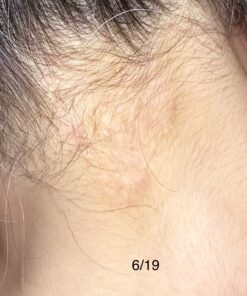 Moisturising Cream, Body and Face Moisturizer for Dry Skin, Acne Cream, 2PC 0.53 Ounce (Pack of 1) 52 919SQzdw0qL