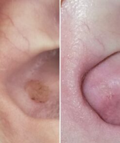 Dr. Scholl's Dual Action Freeze Away WART Remover, 8 Applications // Freeze Therapy + Powerful Fast Acting Salicylic Liquid to Remove Common and Plantar Warts, 0.33 Fl Oz, 1 Count 50 919W8v2nG6L