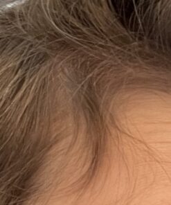 BeLive Biotin Gummies with MultiVitamins, Folate, Inositol – Supports Hair Growth, Healthy Skin & Nails – Vegan, Pectin Based – Strawberry Flavor (1) 60 Count (Pack of 1) 44 91ADdZE3HaL