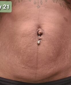 Nivea Skin Firming and Toning Body Gel Cream with Q10, Firming Body Cream, Moisturizing Skin Cream, 6.7 Oz Tube Skin Firming Gel 42 91C6DD7mHHL