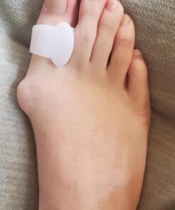 Dr. Frederick's Original 14-Piece Bunion Corrector Kit - Fast Relief for Bunions & Overlapping Toes - For Men & Women - Soft Gel Pads, Spacers, & Separators - For No Surgery Required 14 Piece Assortment 23 91GolZzEjeL 1