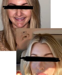 Obagi Medical CLENZIderm M.D. System Pack of 1 25 91V3vCdqEWL