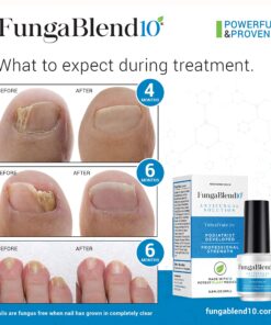 FungaBlend 10 - Antifungal Medication:1% Tolnaftate and 10 Plant Medicines -Toenail Fungus Treatment for Nail Repair Gel, Athletes Foot, Jock Itch, Ringworm -Topical Solution for Toe and Finger Nail 11 91WYHNngzqL