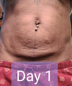 Nivea Skin Firming and Toning Body Gel Cream with Q10, Firming Body Cream, Moisturizing Skin Cream, 6.7 Oz Tube Skin Firming Gel 43 91nE1HaN4wL