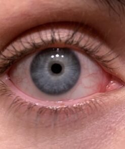 LUMIFY Redness Reliever Eye Drops 0.17 Fl Oz (5 mL) 29 91nO46SiPNL