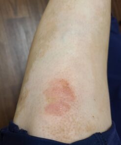 Moisturising Cream, Body and Face Moisturizer for Dry Skin, Acne Cream, 2PC 0.53 Ounce (Pack of 1) 41 A1IY9aRi4wL