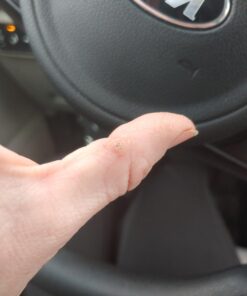 Compound W Wart Remover Maximum Strength One Step Pads, 14 Medicated Pads 14 Count (Pack of 1) 58 A1IlIjiHy5L