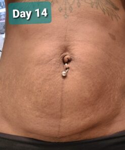 Nivea Skin Firming and Toning Body Gel Cream with Q10, Firming Body Cream, Moisturizing Skin Cream, 6.7 Oz Tube Skin Firming Gel 44 A1PfDAP0omL