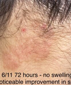 Moisturising Cream, Body and Face Moisturizer for Dry Skin, Acne Cream, 2PC 0.53 Ounce (Pack of 1) 53 A1W rqr9xWL