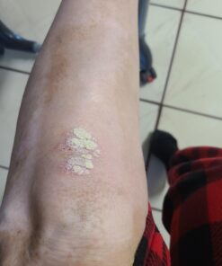 Moisturising Cream, Body and Face Moisturizer for Dry Skin, Acne Cream, 2PC 0.53 Ounce (Pack of 1) 42 A1XVC QBKdL