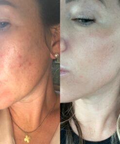 Alani Nu Balance | Supplement for Women | Hormonal Support | Weight Management and Clear Complexion | Gluten Free | Vegan | Sugar Free | 120 Veggie Capsules | 30 Day Supply Unflavored 48 A1de1QHXnSL