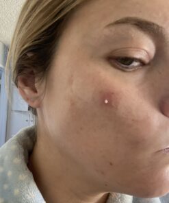 Smile's PRID Drawing Salve by Hyland's, Relief of Topical Pain and Skin Irritations, 18 grams 34 A1eOGOxQkjL