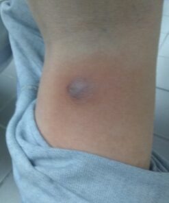 Smile's PRID Drawing Salve by Hyland's, Relief of Topical Pain and Skin Irritations, 18 grams 35 A1mnkxhYbjL