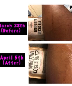 Better Shea Butter Raw Cocoa Butter - Unrefined, 100% Pure, Food Grade - Use for Cocoa Lip Balm, Stretch Marks Cream, Cacao Butter Cream, Scars Oil, Whipped Lotion - Skin & Hair Moisturizer 8 oz Block Bar 8 Ounce (Pack of 1) 41 A1vyyzQxWfL