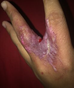 Graftobian Special FX Trauma Pro SFX Makeup Kit - Professional Makeup Kit for Halloween, Cosplay, and Movie, Easy-to-use Cosmetics Collection Set for Beginners, Complete Special Effects Makeup Kit 17 B17oVzFJSZS