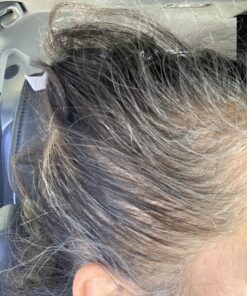 Newopure: Natural Hair Growth Vitamins, Repairs Hair Follicles, Stops Hair Loss, Blocks DHT, Stimulates New Hair Growth, Promotes Thicker, Fuller and Faster Growing Hair. Men & Women (30 Day Supply) 34 B1Cy16TJWBS