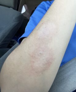 Cortizone 10 Maximum Strength Plus Ultra Moisturizing Anti-Itch Cream, 1% Hydrocortisone, 2 oz. Old Packaging 25 B1DEt0lgQYS