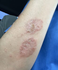 Cortizone 10 Maximum Strength Plus Ultra Moisturizing Anti-Itch Cream, 1% Hydrocortisone, 2 oz. Old Packaging 26 B1KbjF aaXS