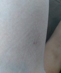 Smile's PRID Drawing Salve by Hyland's, Relief of Topical Pain and Skin Irritations, 18 grams 36 B1ZHip3T5US