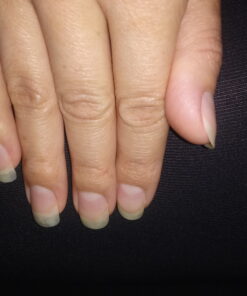 Natrol Biotin Beauty Tablets Promotes Healthy Hair Skin and Nails Helps Support Energy Metabolism Helps Convert Food Into Energy Maximum Strength 10000mcg, Multi, 200 Count 31 B1iDZq9zTCS