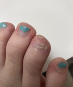 Compound W Maximum Strength One Step Plantar Wart Remover Foot Pads, 20 Count 20 Count (Pack of 1) 42 B1njDQmqROS