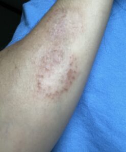 Cortizone 10 Maximum Strength Plus Ultra Moisturizing Anti-Itch Cream, 1% Hydrocortisone, 2 oz. Old Packaging 27 B1qwbPU7yeS