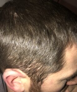 CombPal Scissor Clipper Over Comb Hair Cutting Tool - Barber Hair cutting kit - DIY Home Hair cutting Guide Comb Set (Classic Set, Yellow) 1 Count (Pack of 1) 33 C1BOjY nKCS