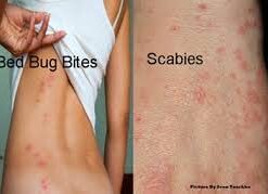 Dr. Berry's Sulfur Lavender Soap | 10% Sulfur Advanced Cleaning Bar (2) 4oz Bars 2 Pack (4oz Bars) 14 21zxupHaAL