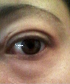 TOULON Eye Cream for Dark Circles, Puffiness and Wrinkles. Reduces Fine Lines with Vitamin C, Peptides & Alpha Hydroxy Acid. Minimizes Crows Feet, Puffy Eyes and Bags 40 31G9dSdu6XL