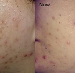 Tree of Life Retinol Serum for Face w/Hydrating Hyaluronic Acid for Wrinkle Soothing, Fine Lines & Dark Spots - 2 Fl Oz - Renew & Reset Nighttime Serums - Dermatologist Tested Facial Skin Care 2 Fl Oz (Pack of 1) 39 31Jhw4I7cL