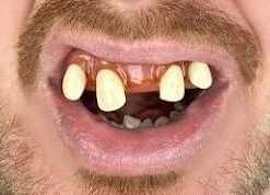 Colgate Total Teeth Whitening Toothpaste, 10 Benefits Including Sensitivity Relief ,Whitening Mint, 4.8 oz ( Pack of 4 ) Whitening Paste 4.8 Ounce (Pack of 4) 32 31TqgE0J93L