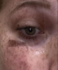 Active Skin Repair Hydrogel - Natural & Non-Toxic First Aid Ointment & Antiseptic Gel for Minor Cuts, Wounds, Scrapes, Rashes, Sunburns, and Other Skin Irritations (Single, 3 oz Gel) 3 Fl Oz (Pack of 1) 47 31klLgKVgFL