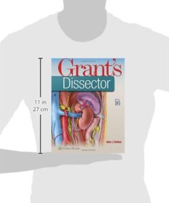 Alternative view of Grant's Dissector