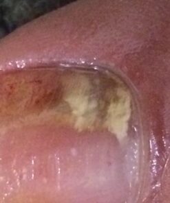 3 in 1 Professional Foot Spa Kit-with Tea Tree Foot & Body Soak-Tea Tree Body Wash & Nail Blend-Soothes Dry, Burning & Itchy Skin-Refreshes Unwanted Foot Odor-Restores Unhealthy Nails-Purely Northwest Tea Tree Oil 3 Piece Set 45 414cZ5IOJzL 1